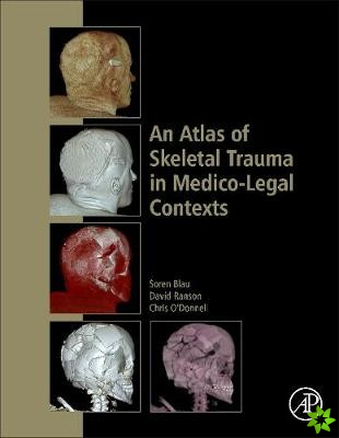 Atlas of Skeletal Trauma in Medico-Legal Contexts