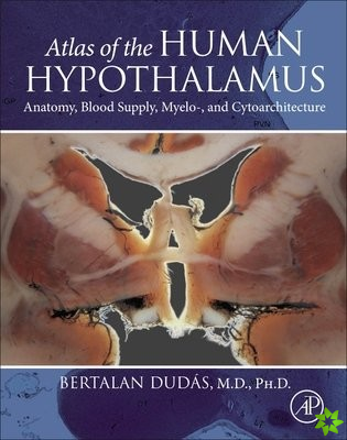 Atlas of the Human Hypothalamus