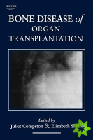 Bone Disease of Organ Transplantation