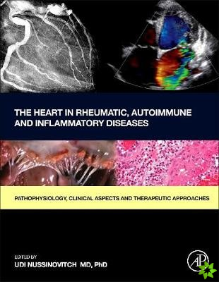 Heart in Rheumatic, Autoimmune and Inflammatory Diseases