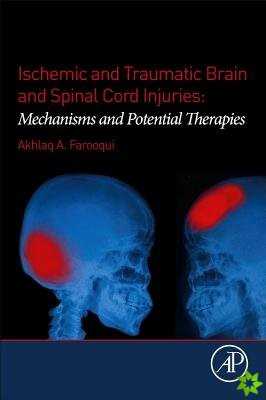 Ischemic and Traumatic Brain and Spinal Cord Injuries