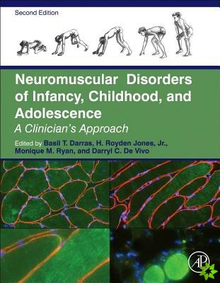 Neuromuscular Disorders of Infancy, Childhood, and Adolescence