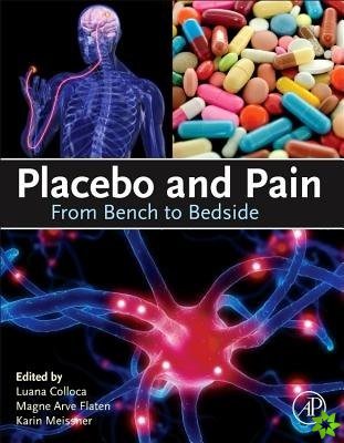 Placebo and Pain