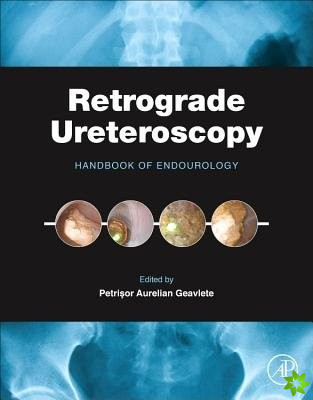 Retrograde Ureteroscopy