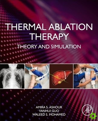 Thermal Ablation Therapy