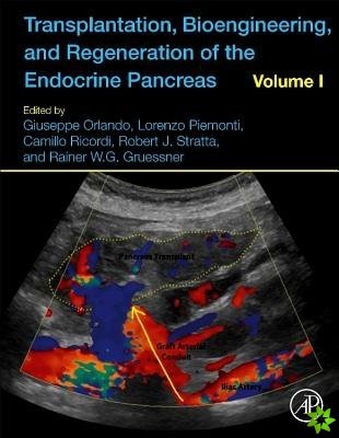 Transplantation, Bioengineering, and Regeneration of the Endocrine Pancreas