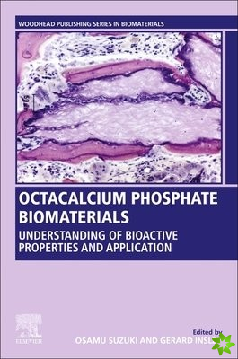 Octacalcium Phosphate Biomaterials