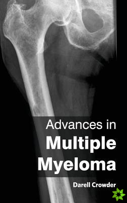 Advances in Multiple Myeloma