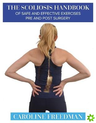 Scoliosis Handbook of Safe and Effective Exercises Pre and Post Surgery