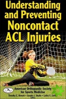 Understanding and Preventing Noncontact ACL Injuries