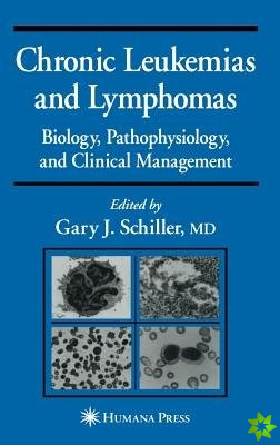 Chronic Leukemias and Lymphomas