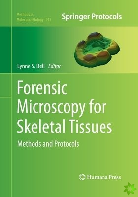 Forensic Microscopy for Skeletal Tissues