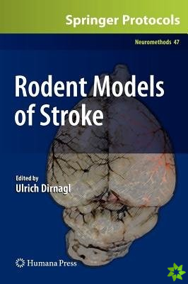 Rodent Models of Stroke