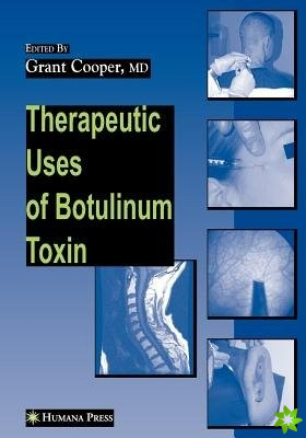 Therapeutic Uses of Botulinum Toxin