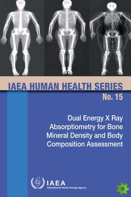 Dual Energy X Ray Absorptiometry for Bone Mineral Density and Body Composition Assessment
