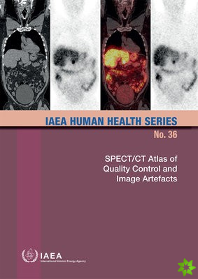 SPECT/CT Atlas of Quality Control and Image Artefacts