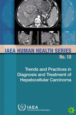 Trends and Practices in Diagnosis and Treatment of Hepatocellular Carcinoma