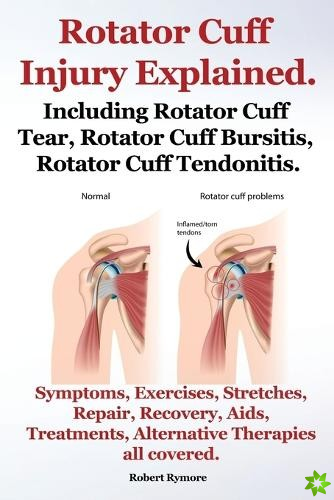 Rotator Cuff Injury Explained. Including Rotator Cuff Tear, Rotator Cuff Bursitis, Rotator Cuff Tendonitis. Symptoms, Exercises, Stretches, Repair, Re