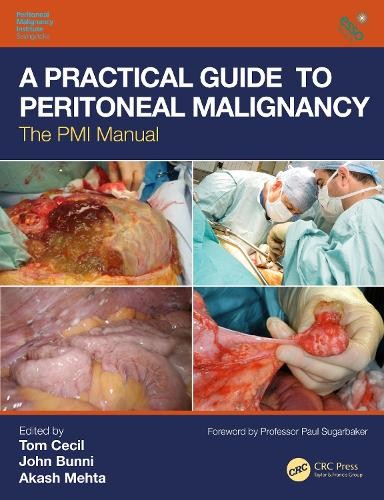 Practical Guide to Peritoneal Malignancy