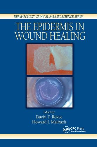 Epidermis in Wound Healing