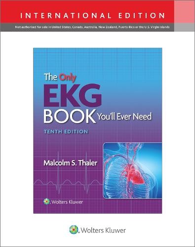 Only EKG Book You'll Ever Need