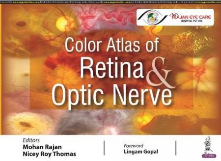 Color Atlas of Retina a Optic Nerve
