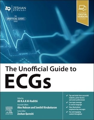 Unofficial Guide to ECGs