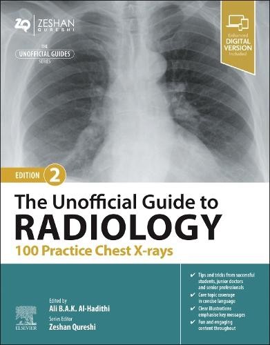 Unofficial Guide to Radiology: 100 Practice Chest X-rays