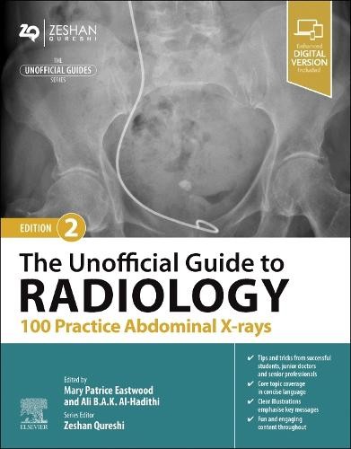 Unofficial Guide to Radiology: 100 Practice Abdominal X-rays