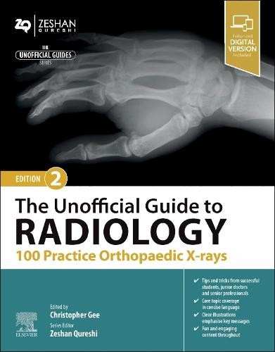 Unofficial Guide to Radiology: 100 Practice Orthopaedic X-rays