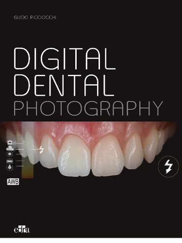 Esthetic Implants -How to think about complex cases in anterior - areas with a global approach to the patient smile (2 books)