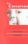 Caesarean