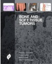 Bone and Soft Tissue Tumors