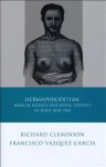Hermaphroditism, Medical Science and Sexual Identity in Spain, 1850–1960