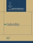 Infertility