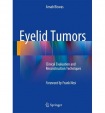 Eyelid Tumors