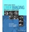 Liver Imaging