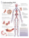 Understanding PAD Paper Poster