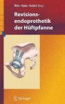 Revisionsendoprothetik der Huftpfanne