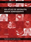 Atlas of Neonatal Brain Sonography