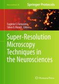 Super-Resolution Microscopy Techniques in the Neurosciences