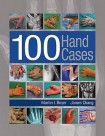 100 Hand Cases