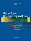 Multiple Ligament Injured Knee