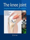 Knee Joint