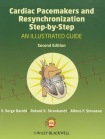 Cardiac Pacemakers and Resynchronization Step by Step