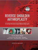 Reverse Shoulder Arthroplasty