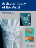 Articular Injury of the Wrist