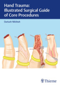 Hand Trauma: Illustrated Surgical Guide of Core Procedures