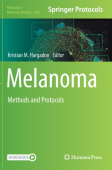 Melanoma