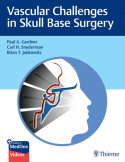 Vascular Challenges in Skull Base Surgery